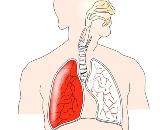 Bagaimana cara menjaga organ pernapasan manusia