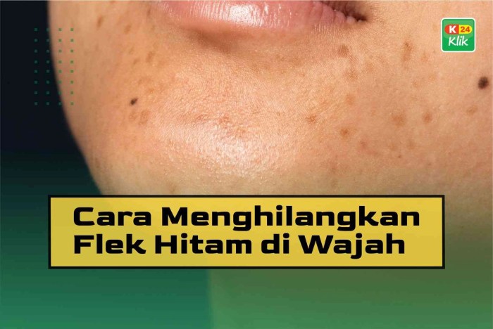 Flek hitam wajah menghilangkan bahan